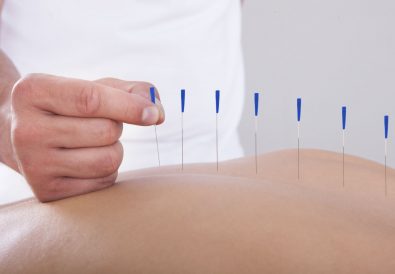 acupuncture-complementary-med-neck-backiStock_000027421898_Medium (1)