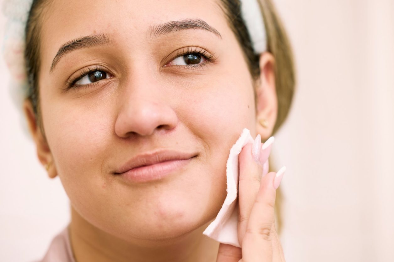 Exploring the Benefits of Colloidal Silver for Acne Management